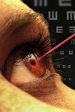 brown eye with red laser and eye chart