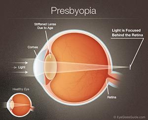 presbyopia eye care in Enid OK