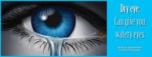 dry eye can give your watery eyes