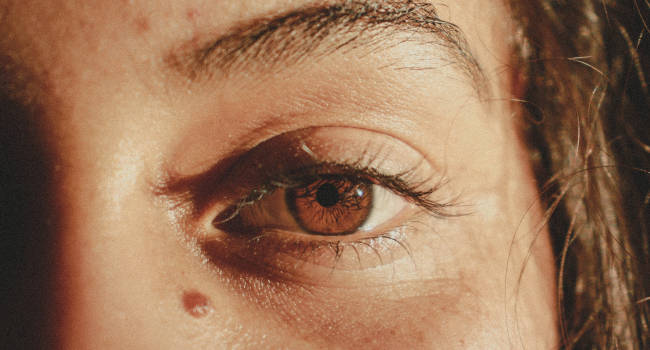 Eyelid Pain Stye Optometrist 650×350