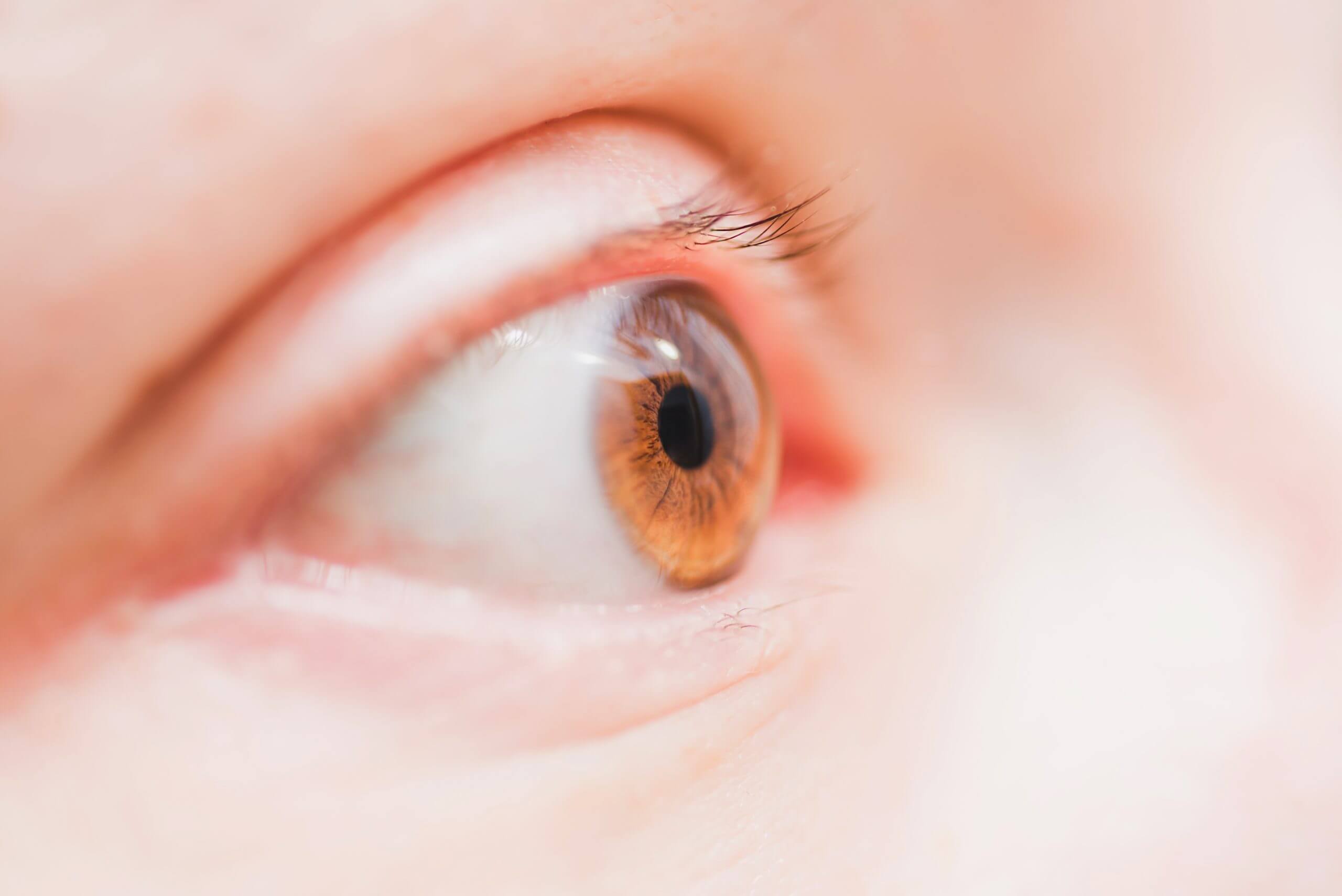 close up of a womans eye orange brown iris JHRJLNY