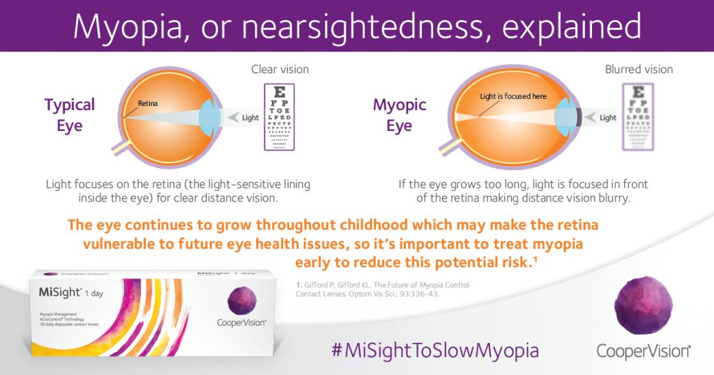 Myopia Graphic, Optometrist, Eye Care, Milton, ON