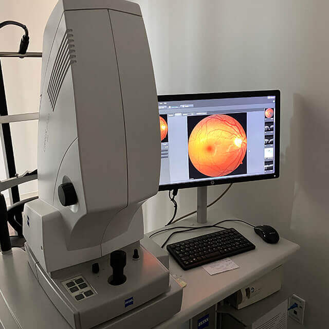glaucoma testing and treatment