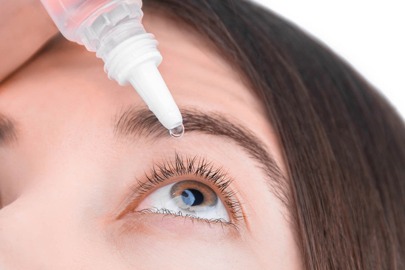A woman puts on eye drops for dry eye.jpg