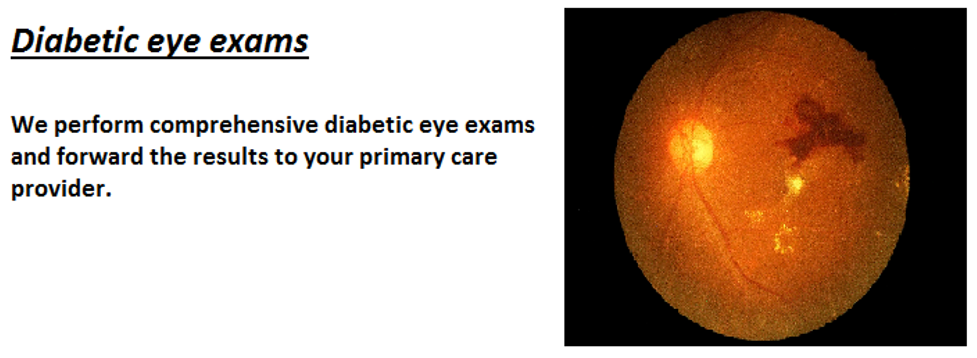Diabetic-Eye-Exam-for-website.png