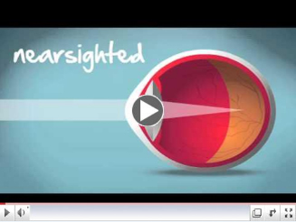 Are Bifocal Trifocal or Progressive lenses right for you blog graphic 660×400