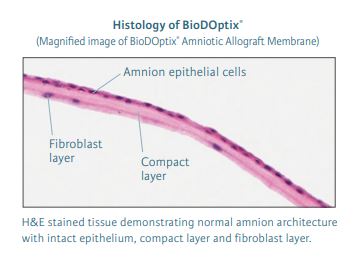 Histology of BioDOptix