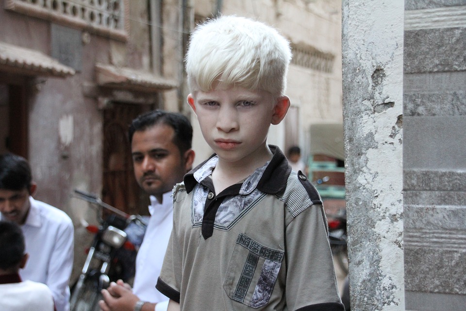 Boy with Albinism on Street Corner