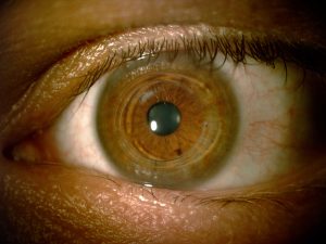 Eye Doctor, Eye Dystrophy in Houston, TX.