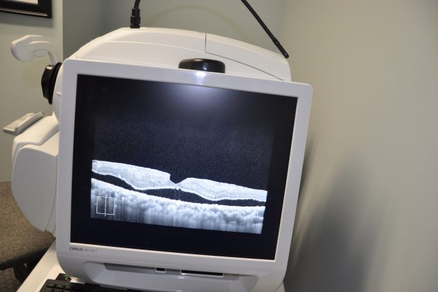 Eye care eye report showing on monitor 3 in Houston TX