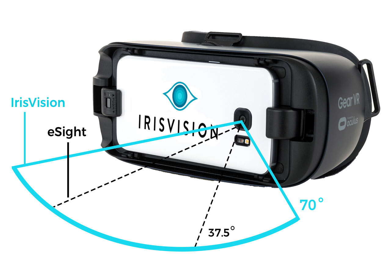 how much does irisvision cost in 