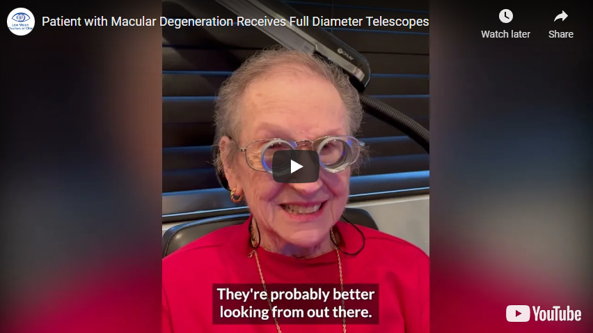 Patient with Macular Degeneration Receives Full Diameter Telescopes