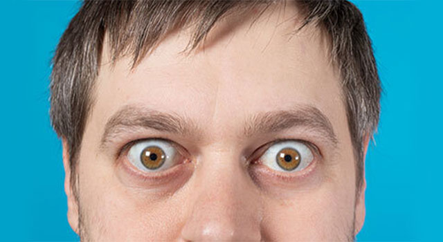 What Causes Bulging Eyes 640×350