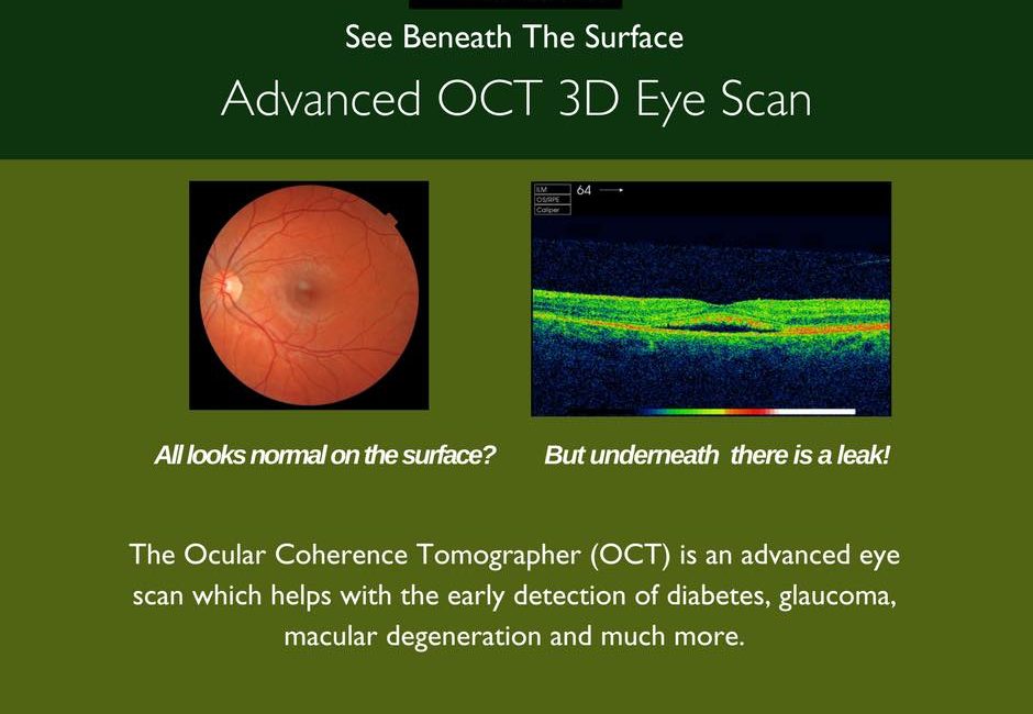 Advanced OCT 3D Eyescan
