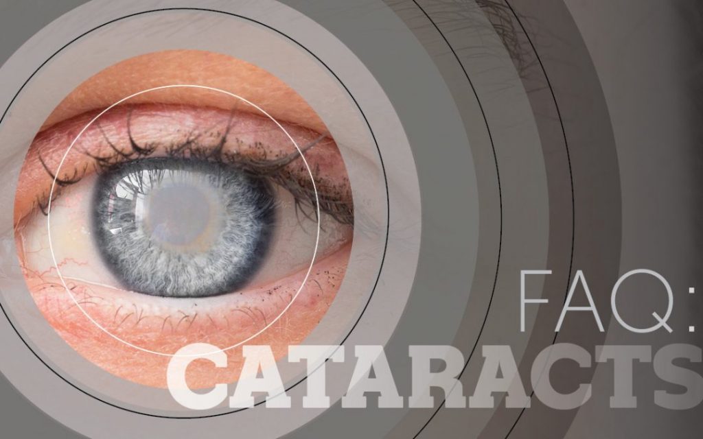 FAQ Cataracts 1080×675