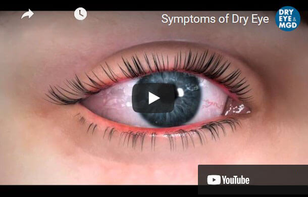 dry eye video picture