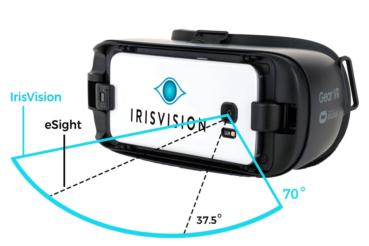 IrisVision Illustration