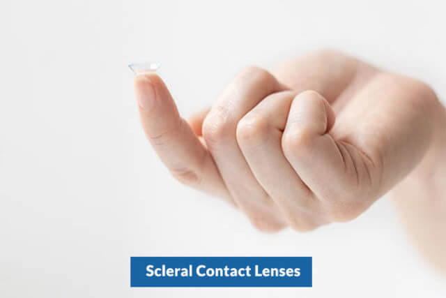 scleral lenses bg