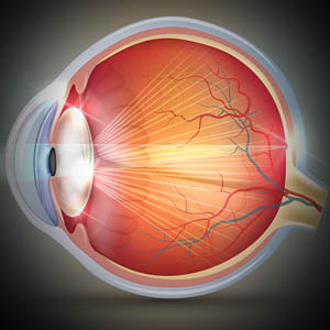 Cataracts, Read +