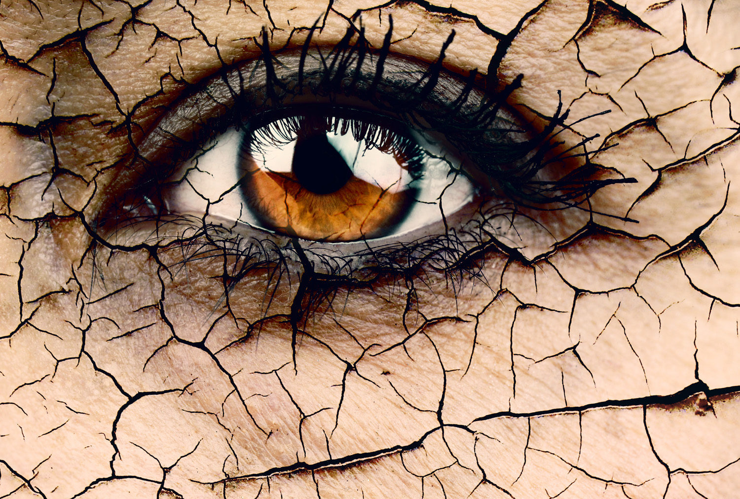 Woman,Eye,Close,Up,Dramatic,Dehydration,Or,Aging,Concept