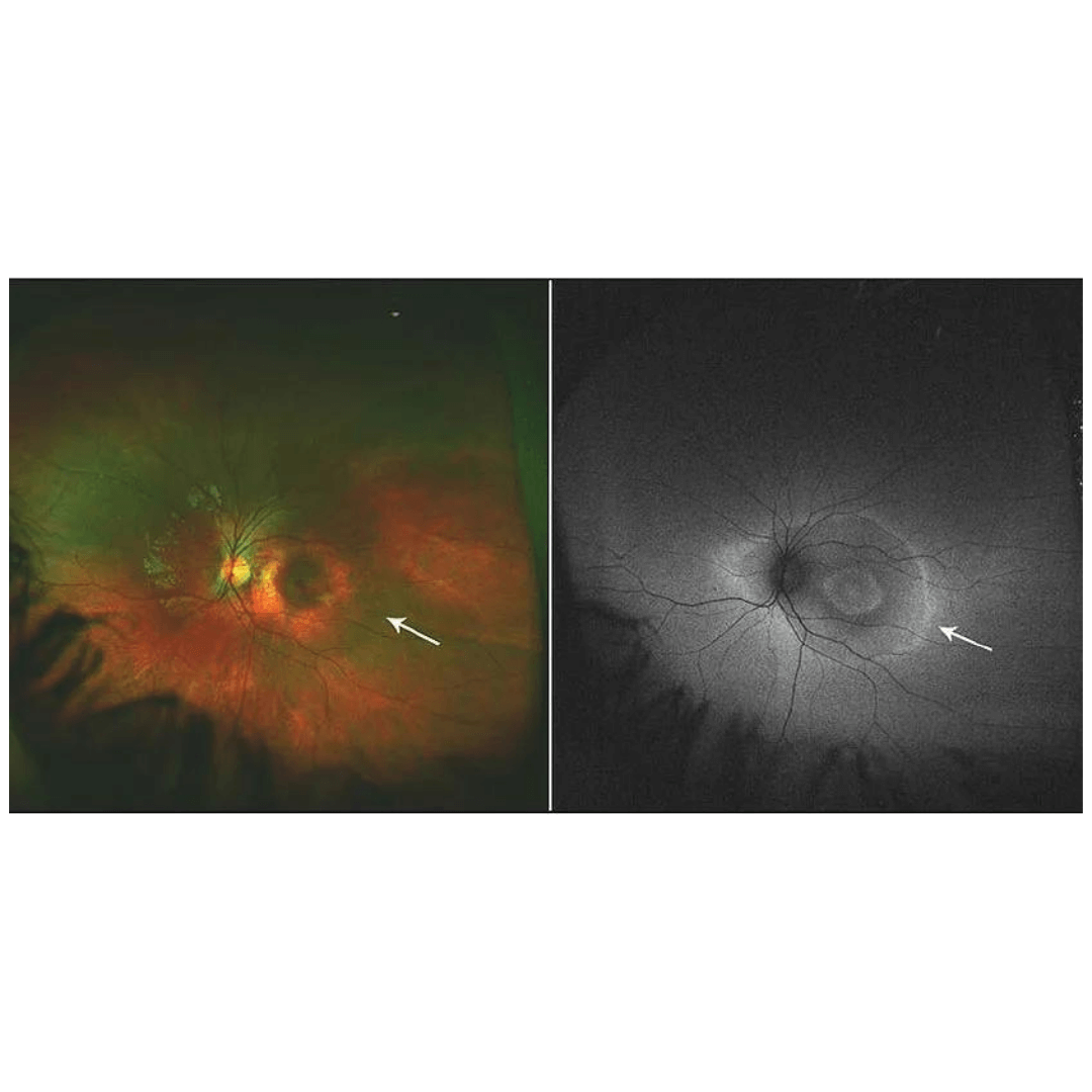 AutoFluorescence with Widefield Imaging (1)