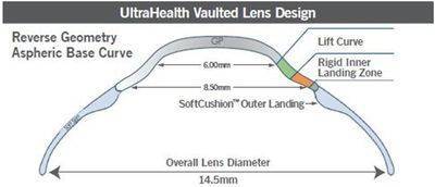 vaulted lens design