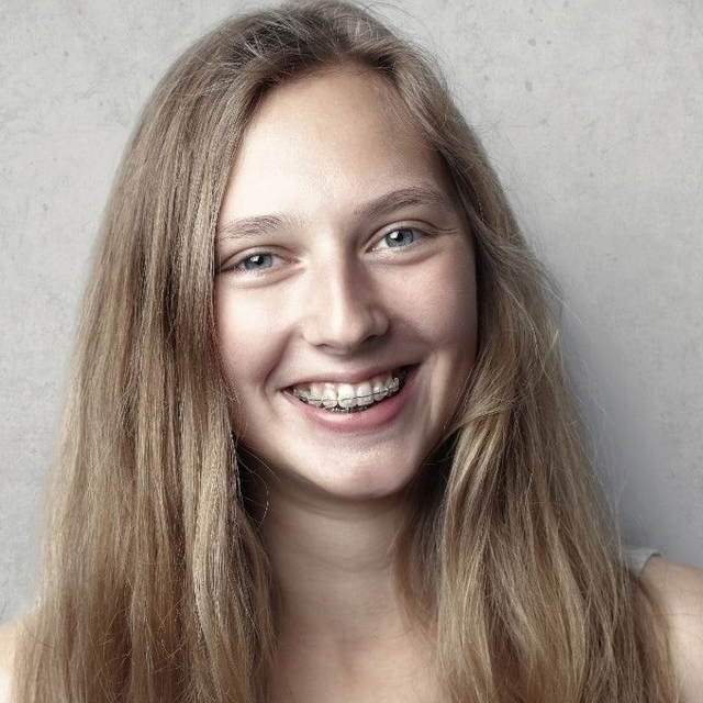 caucasian girl smiling after LASIK surgery