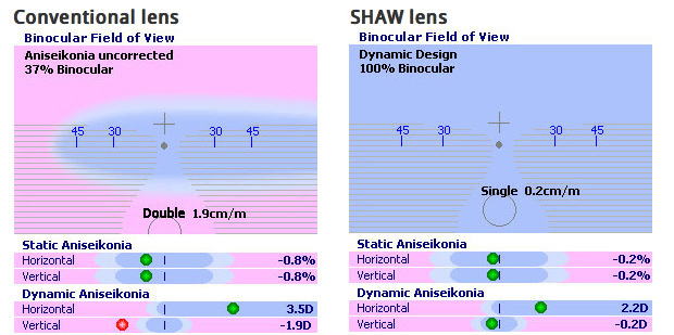 SHAW lens Optometrist Aniseikonia