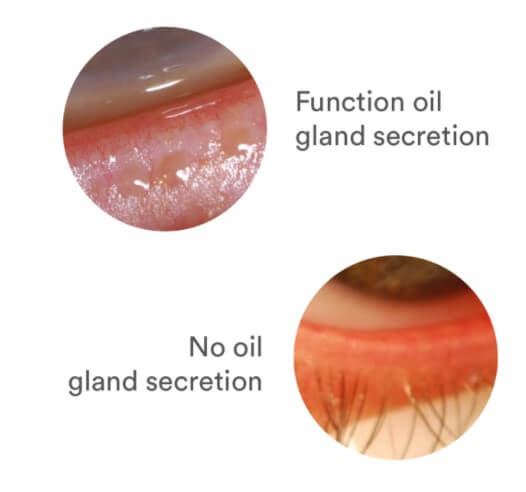 Gland secretion
