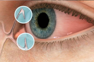 Woman wearing Scleral Lenses scenic view