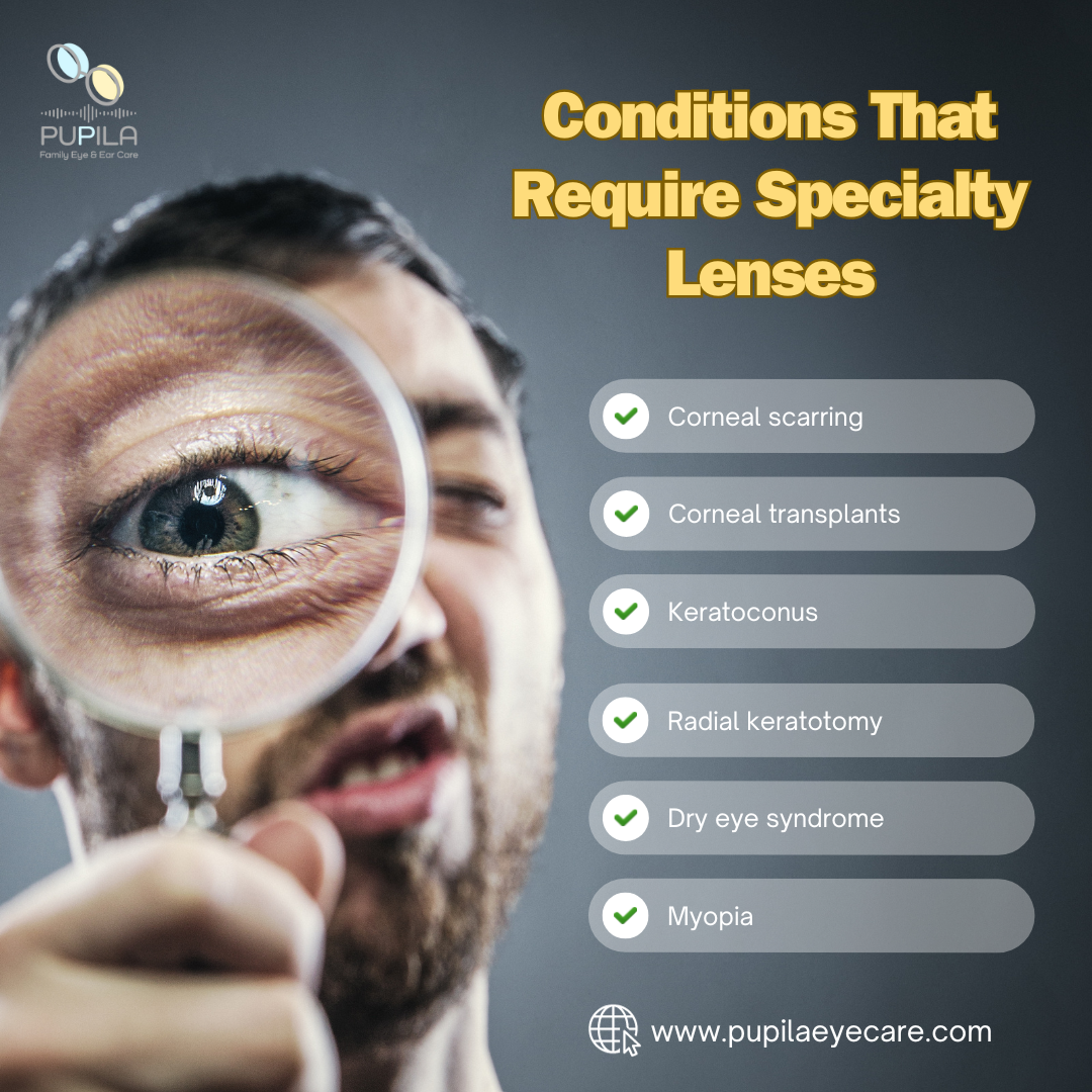 Conditions That Require Specialty Lenses