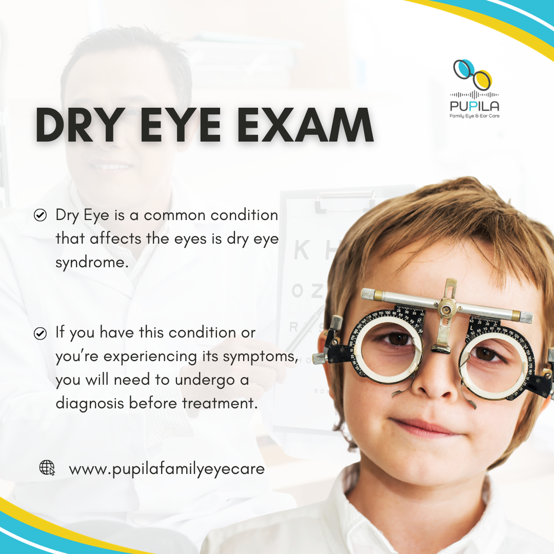 Dry Eye Exam in Houston, TX 