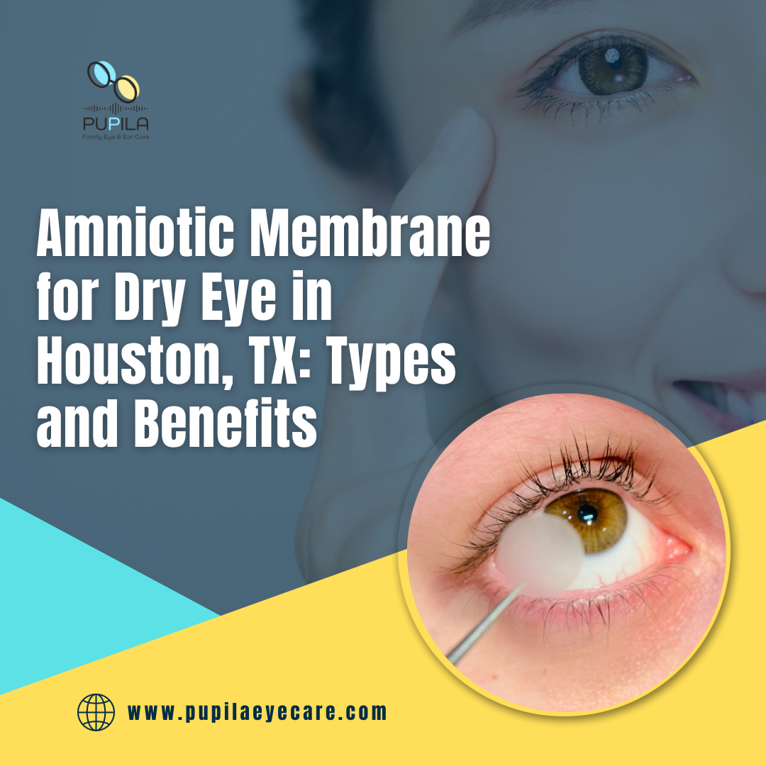 Amniotic Membrane for Dry Eye in Houston, TX Types and Benefits