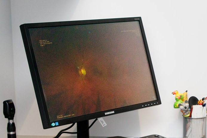 advanced eye care retinal image
