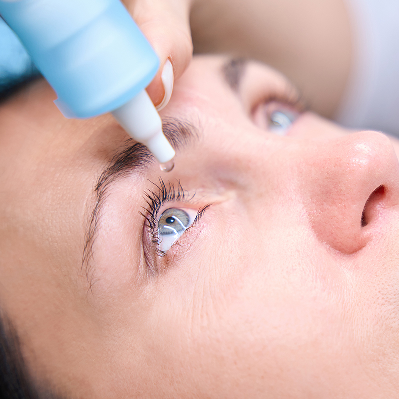 close up of woman receiving dry eye treatment with eye drops