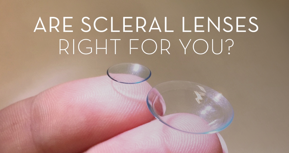 Scleral Lenses 1