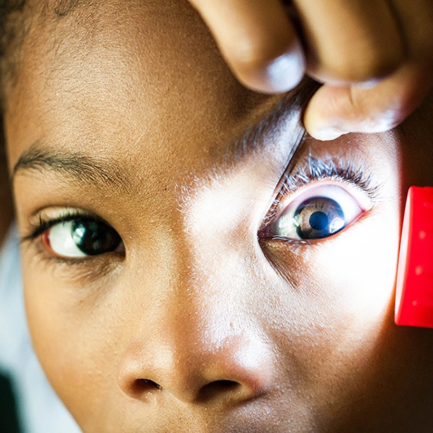Flashlight shining at young persons eye, a hand used to pull eyelid up