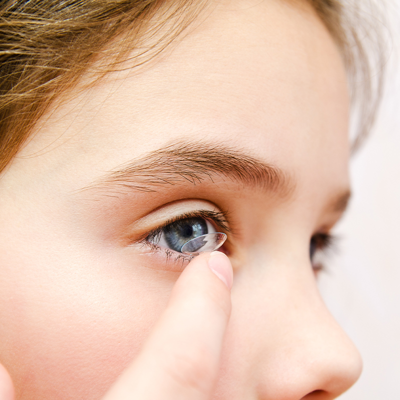 Young Girl Fitting Contact Lenses 2