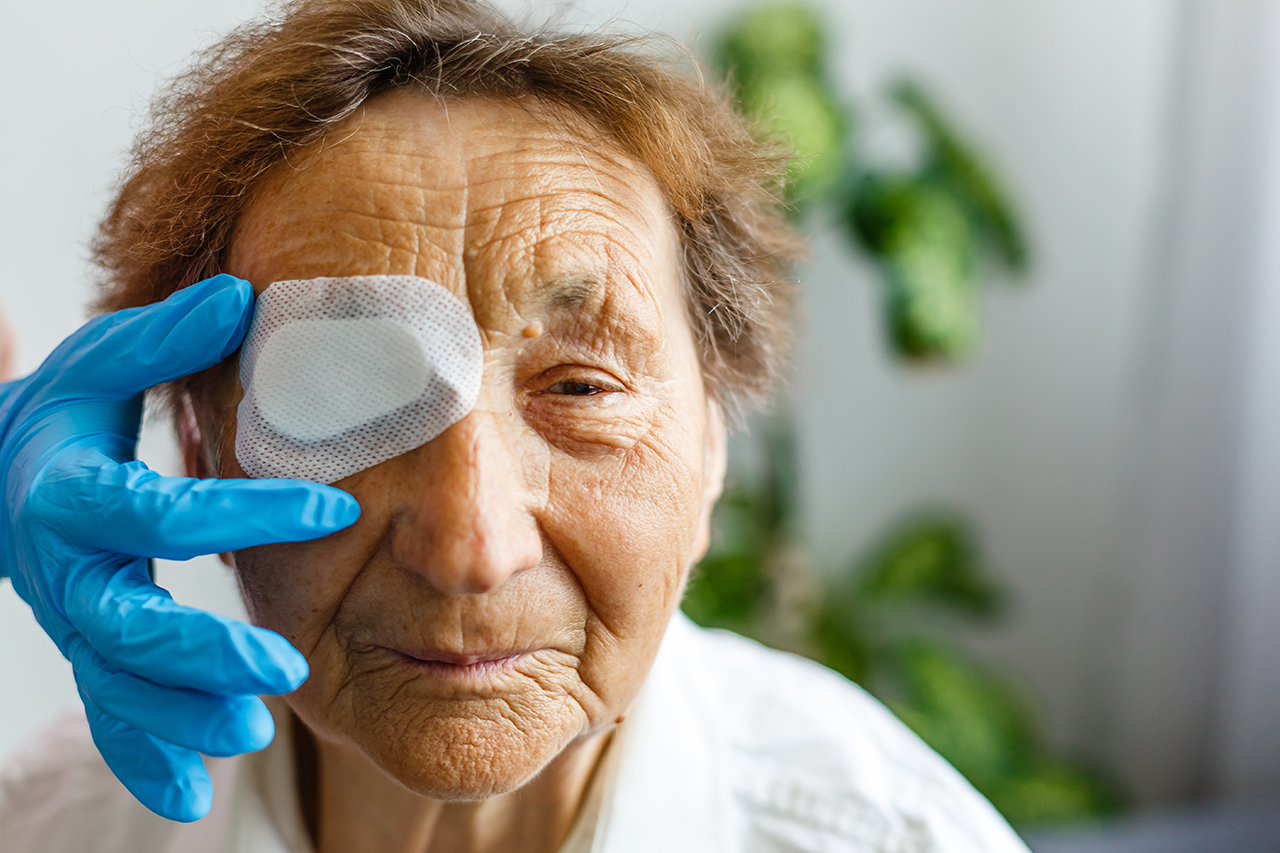 cataract patient wearing eye patch