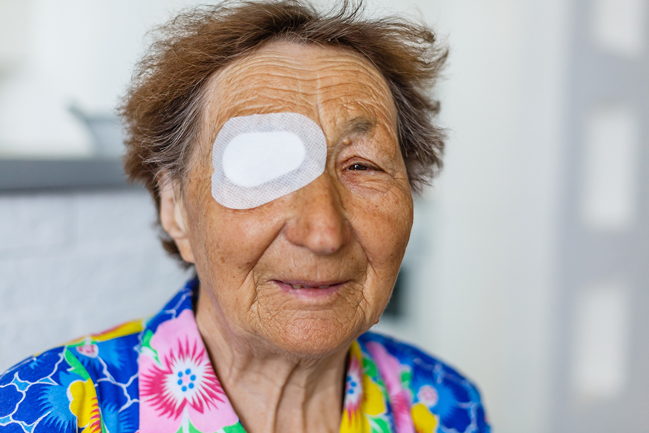 cheerful cataract patient wearing eye patch