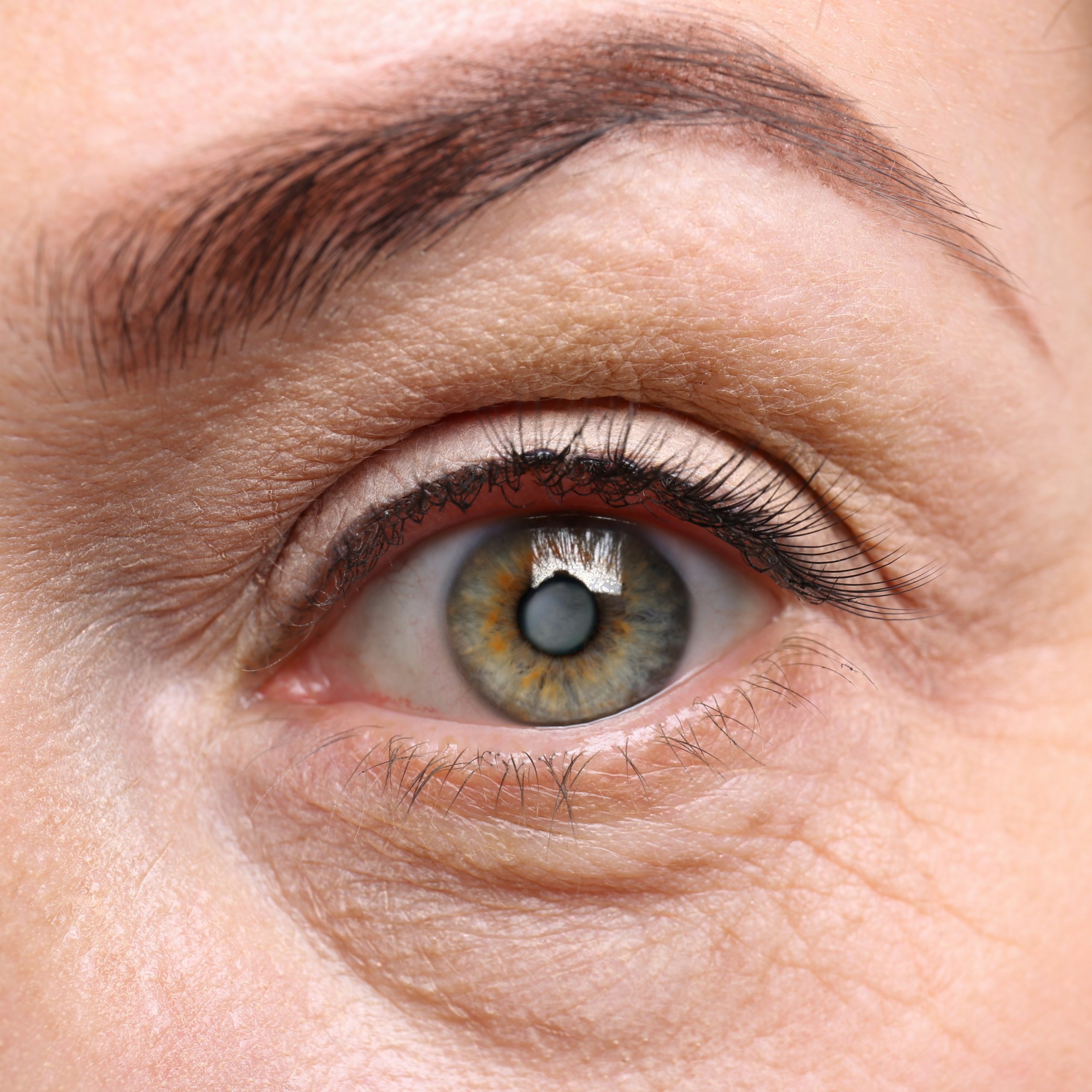 Cataract concept. Senior woman's eye, closeup