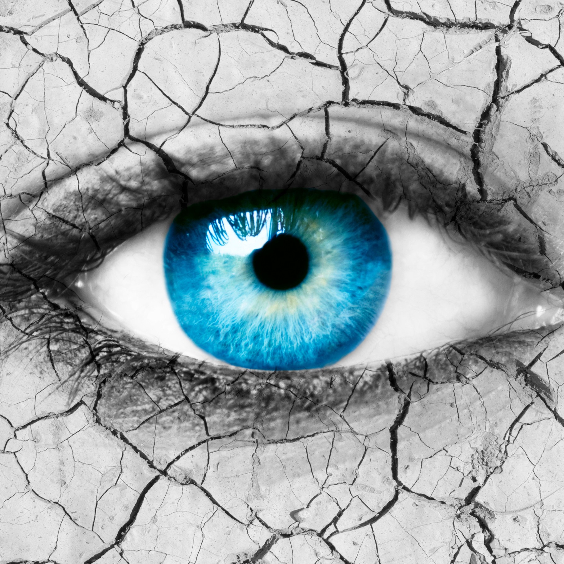 Dry eye image with blue eye