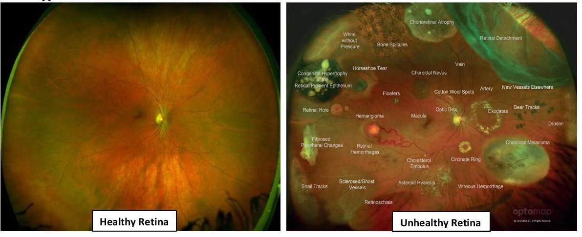 Images of the Retina