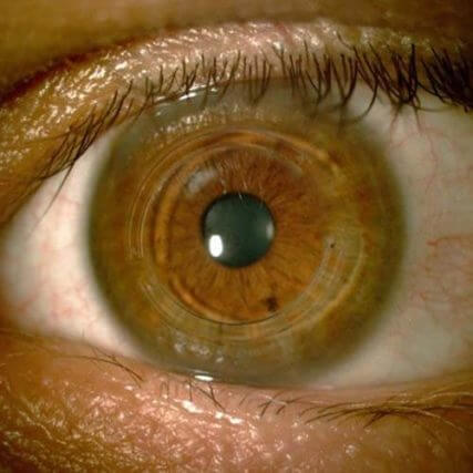 brown green eye close up