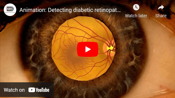 diabetic retinopaty