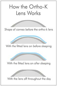 how orthok lens works kent wa