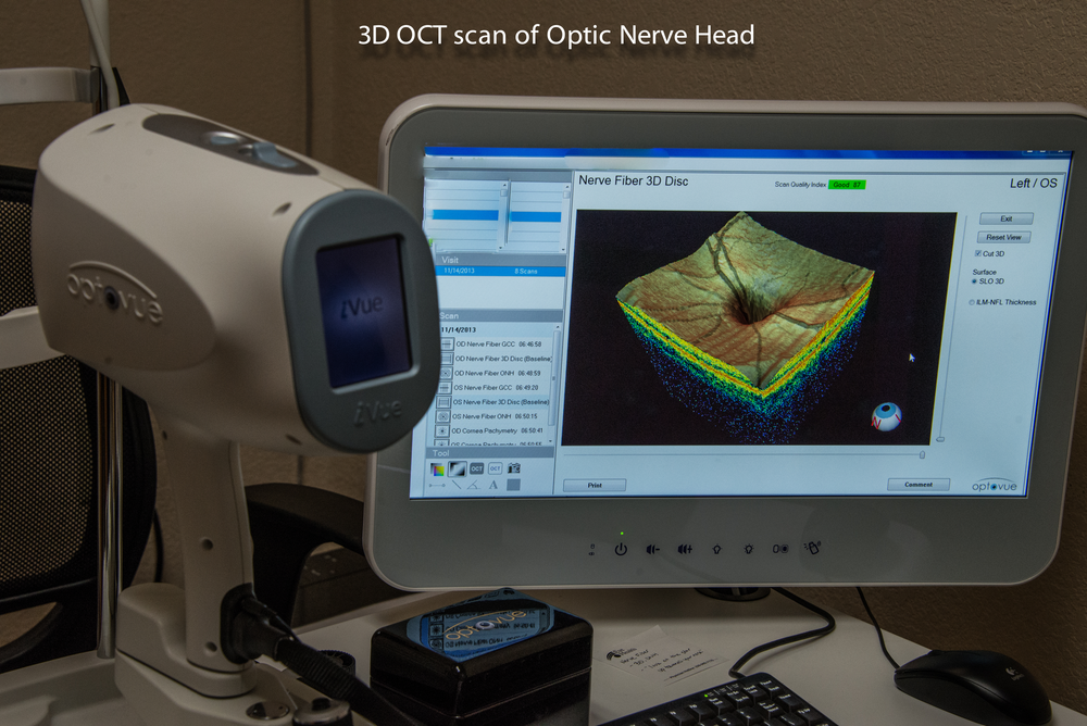 optic-nerve.png