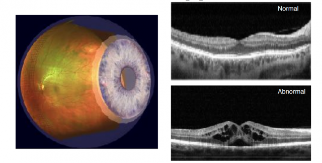 retinal-imaging-iwellness